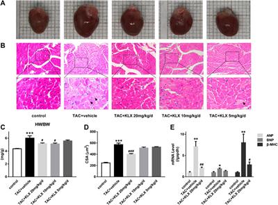 Kanglexin protects against cardiac fibrosis and dysfunction in mice by TGF-β1/ERK1/2 noncanonical pathway